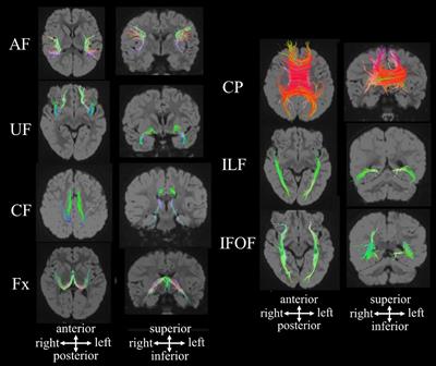 Quantitative Structural Brain Magnetic Resonance Imaging Analyses: Methodological Overview and Application to Rett Syndrome